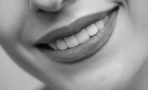 Dermal Fillers for Lips