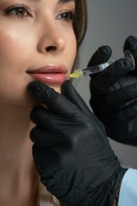Close-up of lip filler treatment showing enhanced lip volume and smooth, defined shape