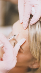 Cosmetic Botox procedure helping reduce facial wrinkles and fine lines in Newmarket