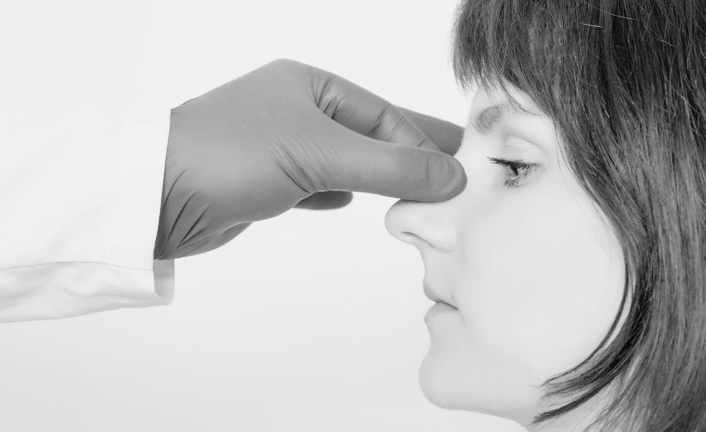 sd-aesthetics-non-surgical-rhinoplasty-03